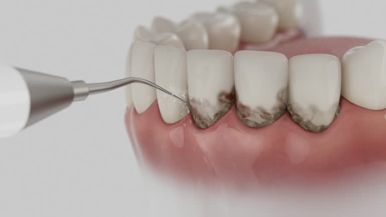 Trusted Wisdom Tooth Removal service in Smithfield, VA - Dentist Open Now